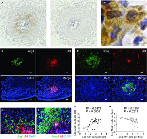 Arg1 Macrophages Accumulated In The Central Area Of Granulomas A