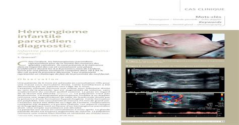 Pdf Infantile Hemangioma Parotid Gland Ultrasonography Pdfslidenet