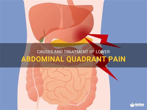 Causes And Treatment Of Lower Abdominal Quadrant Pain Medshun