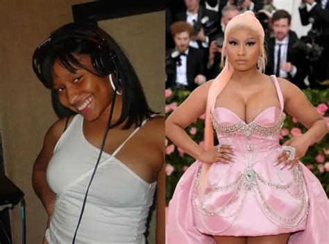 What Did Nicki Minaj Look Like Before Plastic Surgery