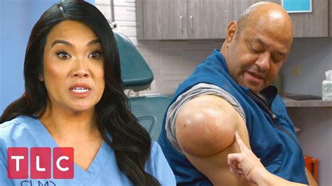 A Weight Off His Shoulder Dr Pimple Popper Extended Youtube