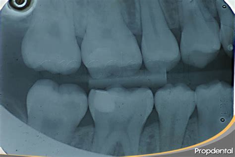 tipos de radiografia dental