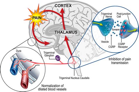 Putative Mechanism Of Action Of CGRP Receptor Antagonists In Migraine