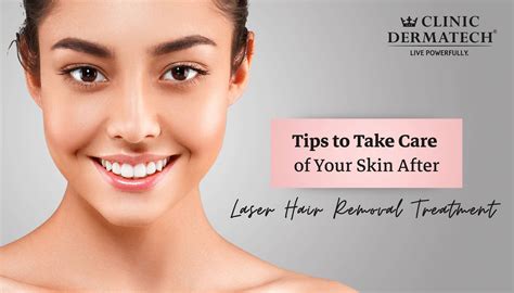 Tips To Take Care Of Your Skin After Laser Hair Removal Treatment