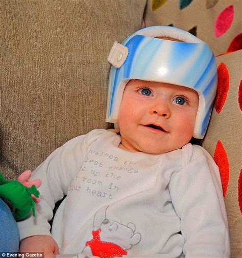 Durham Baby With Flat Head Syndrome Is Now On The Road To Recovery
