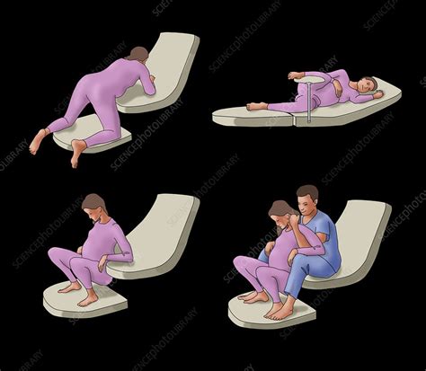 Birthing Positions Illustration Stock Image C039 4360 Science Photo Library