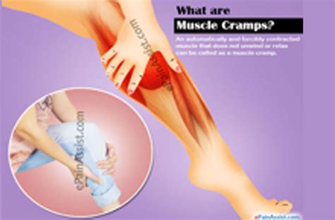 Muscle Cramps Calf Cramp
