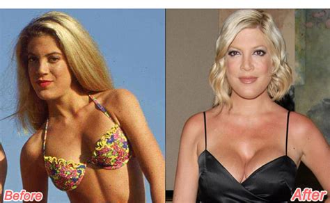 Shocking Celebrity Before After Transformations Page Of Yiral