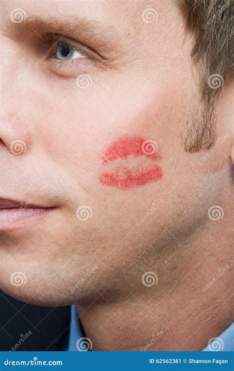 Red Lipstick Kiss On Cheek
