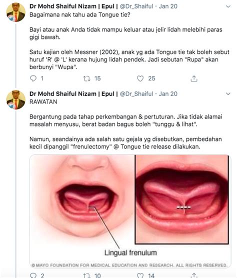 «kenape jelir2 kat mommy ni busyuk oi. Awas! Bayi Anda Mengamuk Ketika Menyusu Mungkin Kerana ...