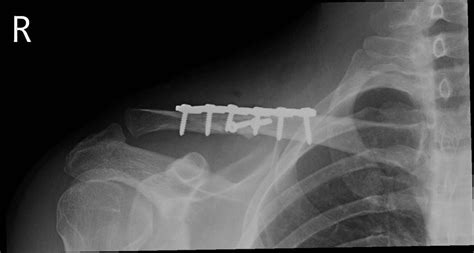 Trauma Cork Surgery Orthopaedic And Sports Medicine Surgery