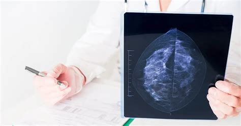 Bi-rads 0 Pode Ser Câncer