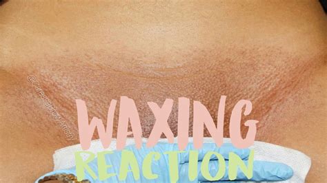 FULL BIKINI WAX Another Reaction Waxing Your Butt Is Painful YouTube