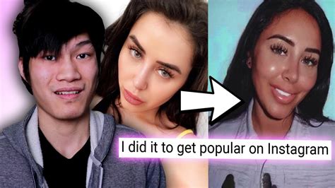 Teenage Girl Gets Plastic Surgery To Look Like A Snapchat Filter