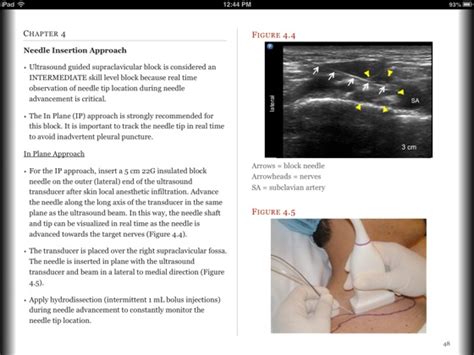‎a Practical Guide To Ultrasound Imaging For Regional Anesthesia Part