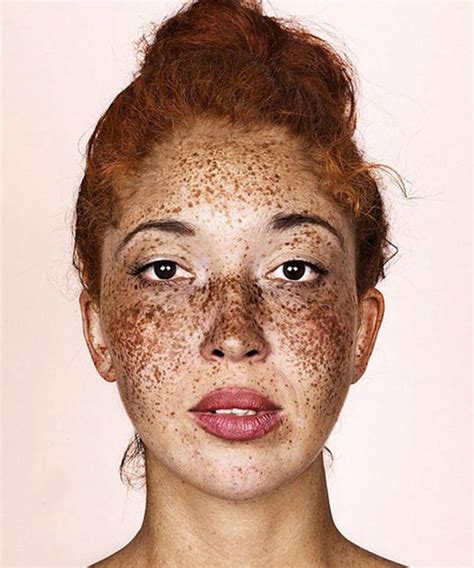 Breathtaking Photos Show The Undeniable Beauty Of Freckles