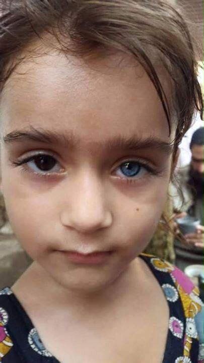 Girl With Heterochromia Iridiumpakistan Pretty Eyes Eye Color Beautiful Eyes