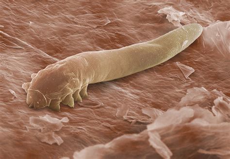 67 Amazing What Mites Can Live On Humans Insectza