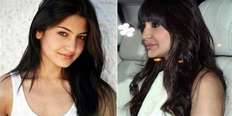 Cosmetic Surgery Messed Up Bollywood Faces