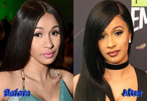 Cardi B Plastic Surgery A New Look For A New Life