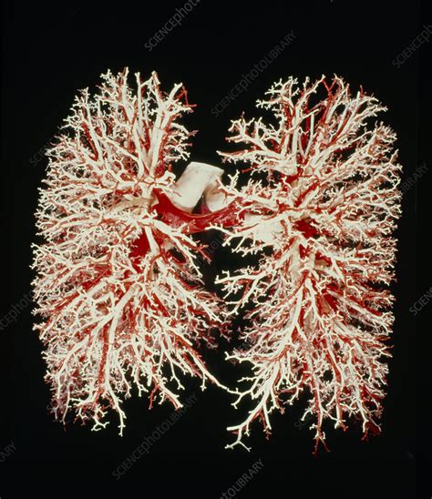 Lung Airways Stock Image P5800001 Science Photo Library