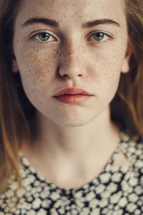 Face Of A Beautiful Girl With Freckles Close Up By Stocksy