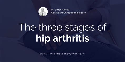 The Three Stages Of Hip Arthritis