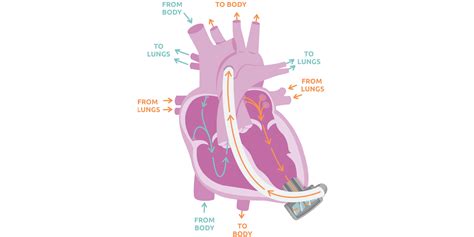 Heartmate 3 Device Components