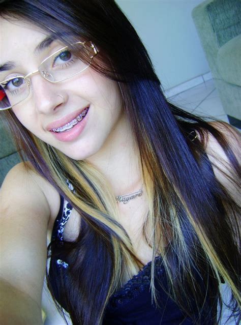 absolutely gorgeous braces glasses and a cute smile post