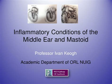 Pdf Inflammatory Conditions Of The Middle Ear And Mastoid