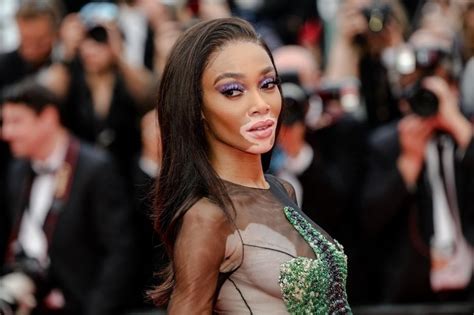 Another Attention Seeker The Scandalous Look Of Model Winnie Harlow