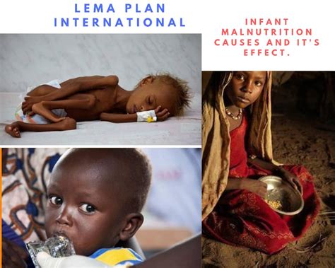 Infant Malnutrition Causes And Effect Lemaplan International