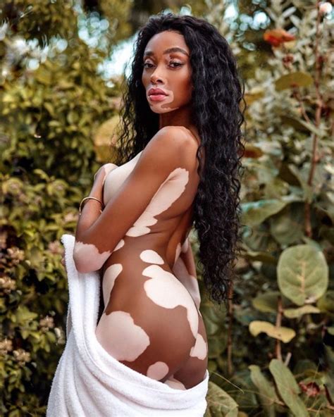 Winnie Harlow Nude Fappening Photos The Fappening