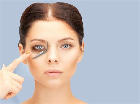 How To Lighten Dark Circles Under Eyes Without Makeup Saubhaya Makeup