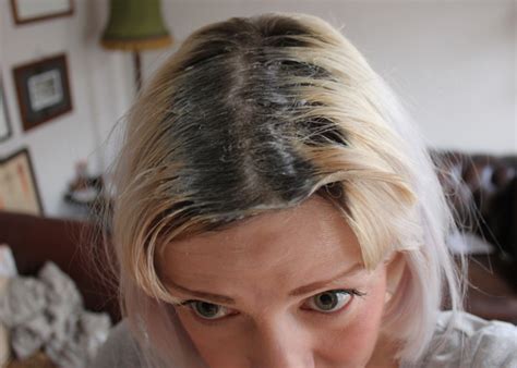 You need to leave the bleach on until you get a * after bleaching and dying, your hair becomes very dry and thirsty. How to Dye Roots at Home - DIY Home Hair Colour