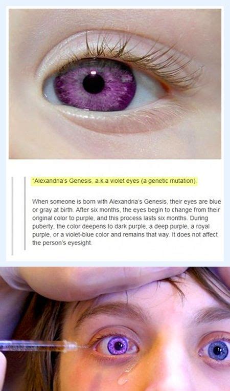 Image Result For Violet Eyes Mutation Real Violet Eyes Purple Eyes