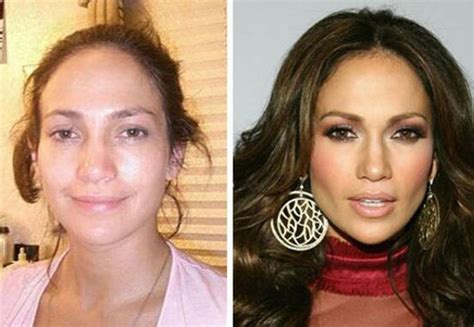 Médico Diz Que Jennifer Lopez Fez Cirurgias Plásticas Mas Artista Nega Quem Quem News