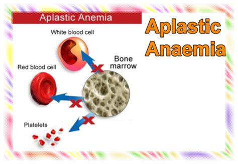 Aplastic Anaemia Sure Developers Team