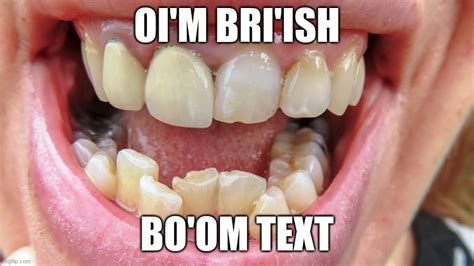 Image Tagged In Funny Memes Funny Memes British Teeth Imgflip