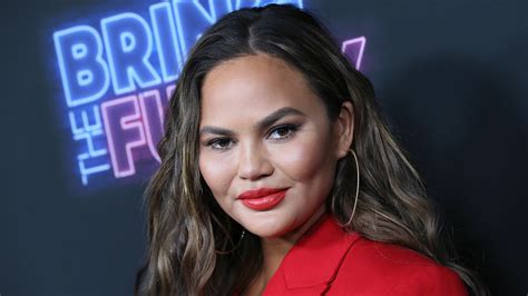 Chrissy Teigen Calls Plastic Surgeon A Piece Of S For Saying She Has A New Face Access