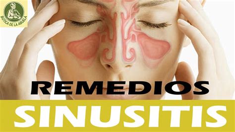 sinusitis remedio natural remedios caseros y naturales para la sinusitis youtube