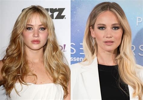 Jennifer Lawrence Before And After Plastic Surgery Boob Nose Teeth