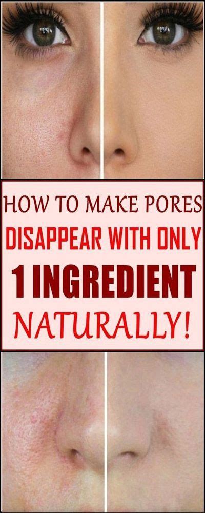 How To Make Pores Disappear With Only 1 Ingredient Naturally Health