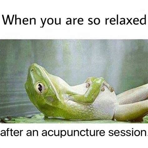 Pin On Acupuncture