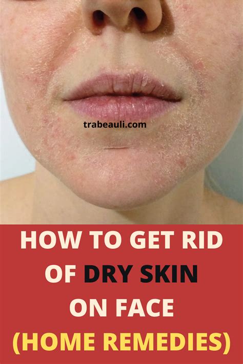 How To Get Rid Of Dry Skin On Face Naturally At Home Trabeauli Dry Skin On Face Healing Dry