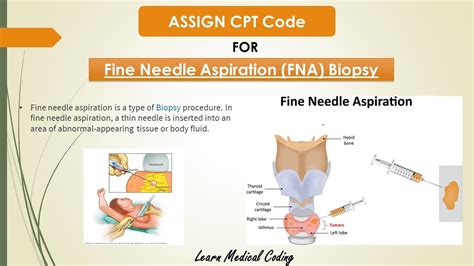 Fine Needle Aspiration CPT Code 2020 Fine Needle Biopsy CPT Code