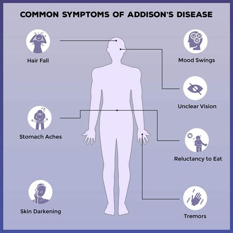 Is Addison S Disease Genetic Decode With Xcode