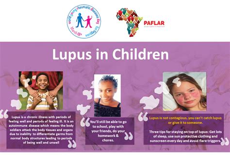 Lupus In Children Paflar