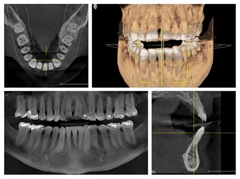 3d X Rays Westmount Dental Arts