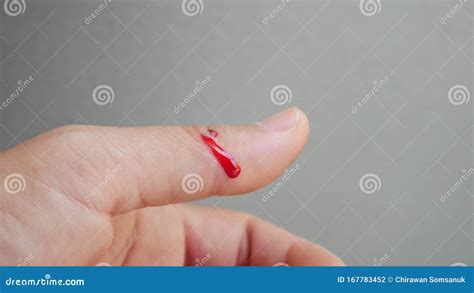 Fresh Wound With Blood In Finger Stock Photo Image Of Clean